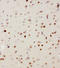 Mitogen-Activated Protein Kinase Kinase Kinase 3 antibody, LS-C313061, Lifespan Biosciences, Immunohistochemistry frozen image 