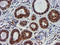 TIMP Metallopeptidase Inhibitor 2 antibody, LS-C173579, Lifespan Biosciences, Immunohistochemistry paraffin image 