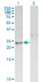 Deoxythymidylate Kinase antibody, LS-C197087, Lifespan Biosciences, Western Blot image 