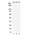 Tenascin XB antibody, R32015, NSJ Bioreagents, Western Blot image 