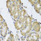 Calcium/Calmodulin Dependent Protein Kinase II Gamma antibody, LS-C332440, Lifespan Biosciences, Immunohistochemistry paraffin image 
