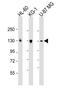 DEP Domain Containing 5 antibody, MBS9207358, MyBioSource, Western Blot image 