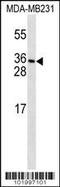 Platelet Derived Growth Factor C antibody, 59-045, ProSci, Western Blot image 