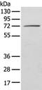 Insulin Like Growth Factor 2 MRNA Binding Protein 3 antibody, PA5-51136, Invitrogen Antibodies, Western Blot image 