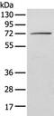 Insulin Like Growth Factor 2 MRNA Binding Protein 3 antibody, PA5-51136, Invitrogen Antibodies, Western Blot image 