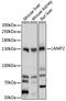 Lysosomal Associated Membrane Protein 2 antibody, A01573-1, Boster Biological Technology, Western Blot image 