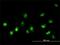 NIMA Related Kinase 11 antibody, H00079858-M01, Novus Biologicals, Immunocytochemistry image 