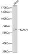 Mannan Binding Lectin Serine Peptidase 1 antibody, 19-799, ProSci, Western Blot image 