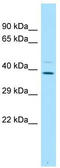 Phospholipid Scramblase 4 antibody, TA331285, Origene, Western Blot image 
