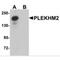 Pleckstrin Homology And RUN Domain Containing M2 antibody, MBS150207, MyBioSource, Western Blot image 