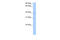 Annexin A8 Like 1 antibody, 28-514, ProSci, Western Blot image 