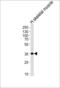 Protein Phosphatase 1 Regulatory Subunit 3B antibody, 59-734, ProSci, Western Blot image 