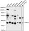 N-Acetylglucosamine Kinase antibody, GTX64828, GeneTex, Western Blot image 