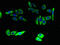 ELOVL Fatty Acid Elongase 5 antibody, LS-C398674, Lifespan Biosciences, Immunofluorescence image 