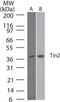 TERF1 Interacting Nuclear Factor 2 antibody, MA1-91513, Invitrogen Antibodies, Western Blot image 