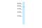 Transmembrane Protein 175 antibody, PA5-68633, Invitrogen Antibodies, Western Blot image 