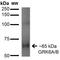 G Protein-Coupled Receptor Kinase 5 antibody, MA5-27695, Invitrogen Antibodies, Western Blot image 