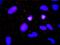ADAM Metallopeptidase Domain 17 antibody, orb89692, Biorbyt, Immunocytochemistry image 
