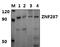 Zinc Finger Protein 287 antibody, PA5-75973, Invitrogen Antibodies, Western Blot image 