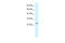 Zinc Finger AN1-Type Containing 6 antibody, 28-100, ProSci, Western Blot image 