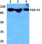 Discs Large MAGUK Scaffold Protein 2 antibody, A04826-1, Boster Biological Technology, Western Blot image 
