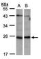 Inosine triphosphate pyrophosphatase antibody, NBP1-32494, Novus Biologicals, Western Blot image 