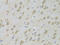 G Protein-Coupled Receptor Kinase 3 antibody, 18-466, ProSci, Immunohistochemistry paraffin image 