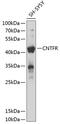 Ciliary Neurotrophic Factor Receptor antibody, A05979, Boster Biological Technology, Western Blot image 