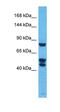 Lysine Demethylase 3B antibody, orb329699, Biorbyt, Western Blot image 