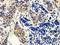 Glycoprotein Ib Platelet Subunit Alpha antibody, orb247044, Biorbyt, Immunohistochemistry paraffin image 
