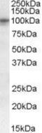 Taste 1 Receptor Member 2 antibody, GTX88873, GeneTex, Western Blot image 