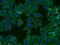 Solute Carrier Family 27 Member 2 antibody, 14048-1-AP, Proteintech Group, Immunofluorescence image 