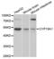 Cytochrome P450 Family 19 Subfamily A Member 1 antibody, abx001773, Abbexa, Western Blot image 