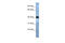 Transmembrane Protein 115 antibody, 26-169, ProSci, Enzyme Linked Immunosorbent Assay image 