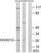 Homeobox D12 antibody, GTX87077, GeneTex, Western Blot image 