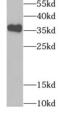 Tropomyosin 2 antibody, FNab08889, FineTest, Western Blot image 