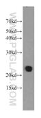 Transmembrane Protein 139 antibody, 21912-1-AP, Proteintech Group, Western Blot image 