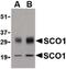 SCO Cytochrome C Oxidase Assembly Protein 1 antibody, PA5-20345, Invitrogen Antibodies, Western Blot image 