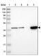 Solute Carrier Family 35 Member E1 antibody, NBP1-94009, Novus Biologicals, Western Blot image 