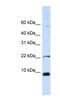 Small Nuclear Ribonucleoprotein Polypeptide F antibody, NBP1-57464, Novus Biologicals, Western Blot image 