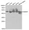 Heterogeneous Nuclear Ribonucleoprotein F antibody, abx004220, Abbexa, Western Blot image 