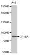 Glycoprotein Ib Platelet Subunit Alpha antibody, MBS127195, MyBioSource, Western Blot image 