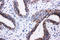 Phosphoinositide-3-Kinase Regulatory Subunit 2 antibody, LS-C312832, Lifespan Biosciences, Immunohistochemistry paraffin image 