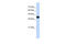 Insulin gene enhancer protein ISL-2 antibody, 25-562, ProSci, Enzyme Linked Immunosorbent Assay image 