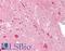 Myogenic Factor 5 antibody, LS-B10723, Lifespan Biosciences, Immunohistochemistry paraffin image 