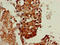 Serpin Family I Member 1 antibody, LS-C679431, Lifespan Biosciences, Immunohistochemistry paraffin image 