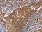 Peptidase, Mitochondrial Processing Beta Subunit antibody, MBS2518578, MyBioSource, Immunohistochemistry paraffin image 