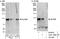 Nucleoporin 98 antibody, A301-786A, Bethyl Labs, Western Blot image 