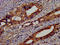 Eukaryotic Translation Initiation Factor 3 Subunit G antibody, LS-C370594, Lifespan Biosciences, Immunohistochemistry paraffin image 