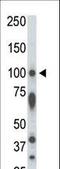 Serine/Threonine Kinase 31 antibody, LS-C100781, Lifespan Biosciences, Western Blot image 